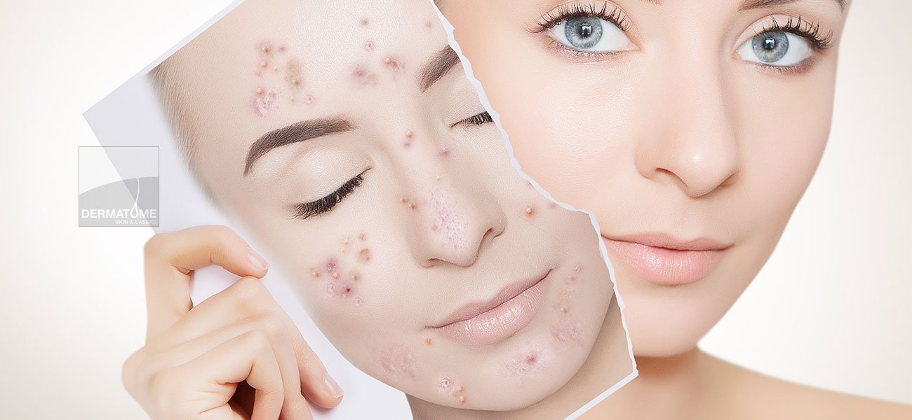 Aesthetic Dermatology at Dermatome Skin & Lasers, Palakkad