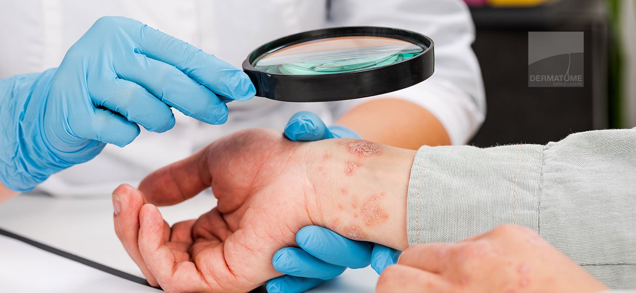 Clinical Dermatology