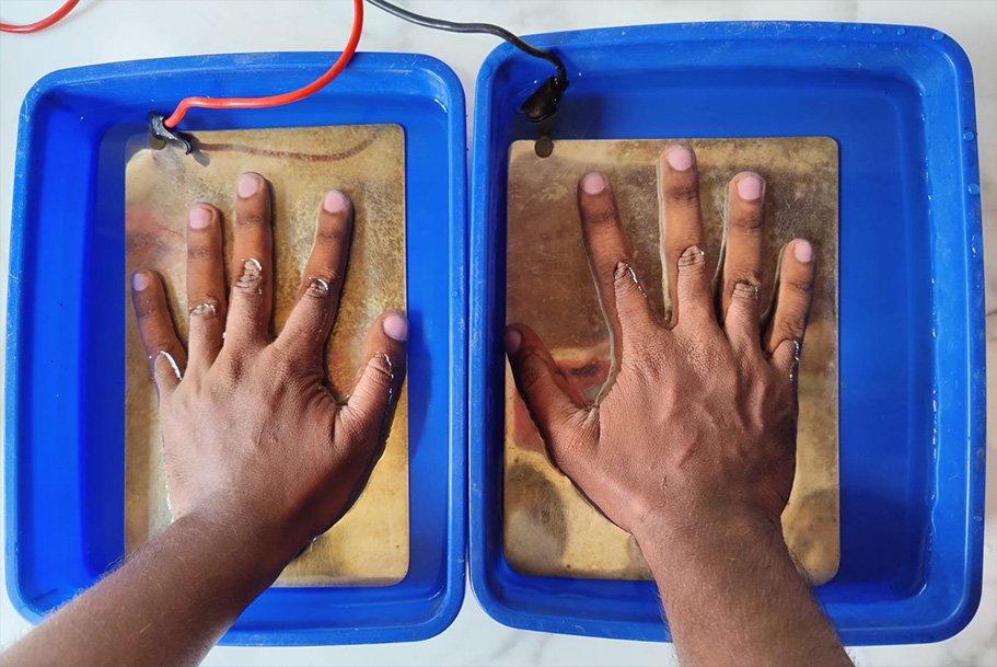 Iontophoresis 2