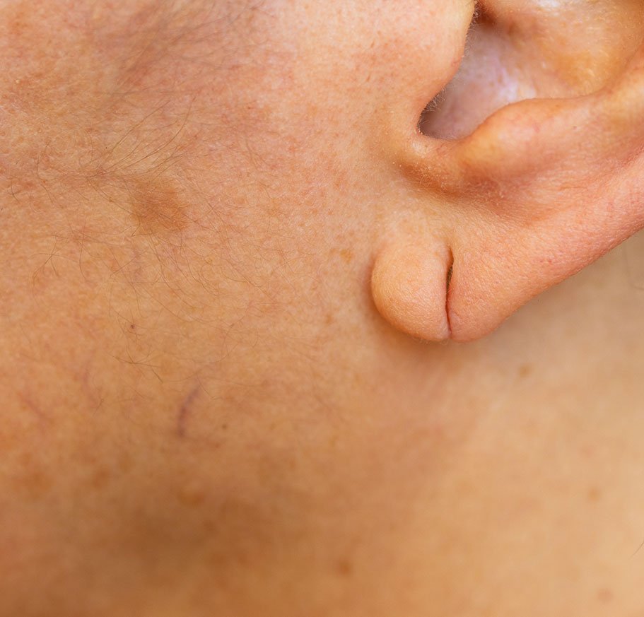 Surgical Dermatology 1